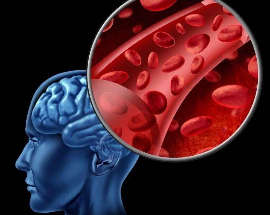 simptomatika-pri-ishemii-golovnogo-mozga-1024x818-2021